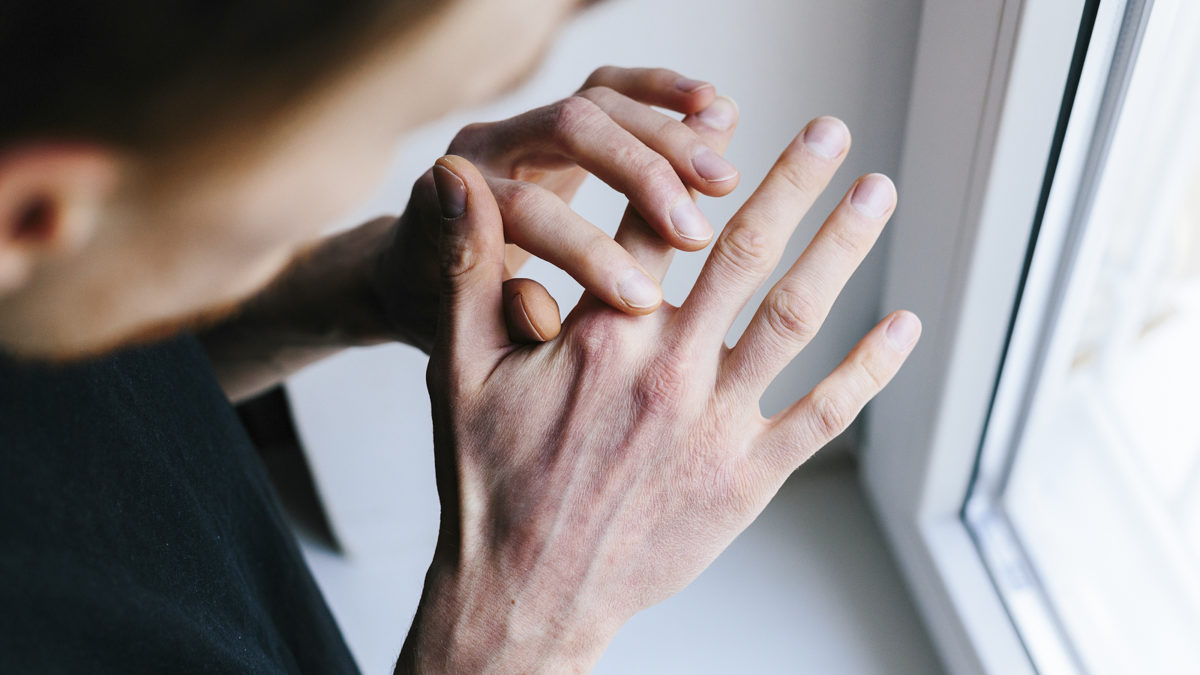 Man with dry hands.